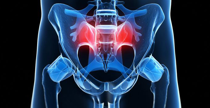 Sacroiliac Joint Fusion Specialist