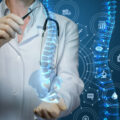 What Is Spinal Cord Stimulation