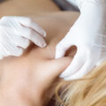 Interventional Pain Management