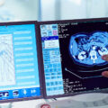 Medical Imaging Scans
