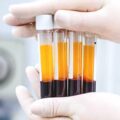 Can I drink alcohol before PRP injection