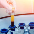 How long does a PRP injection last