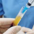 How many times can you have PRP injections