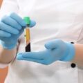 What to do after PRP injection