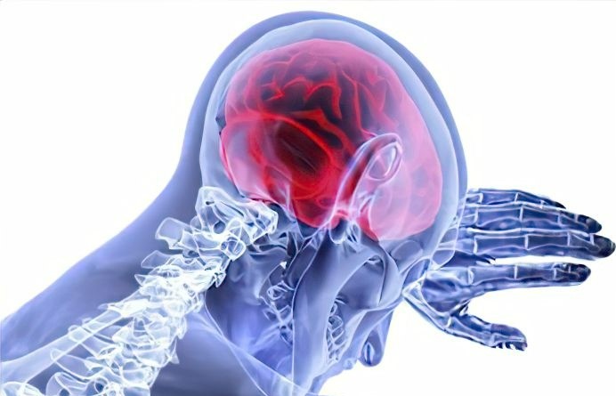 Can whiplash cause brain injury