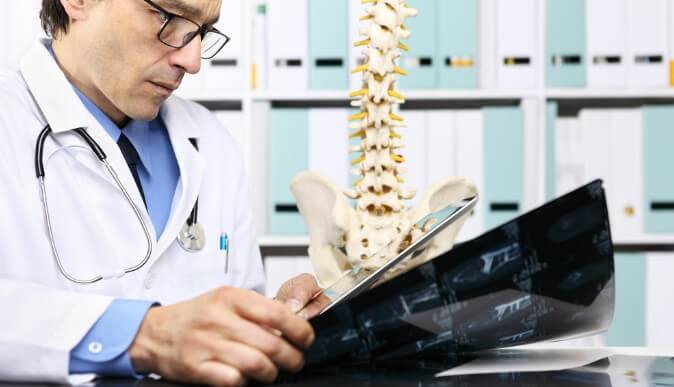 Sciatic Nerve Pain