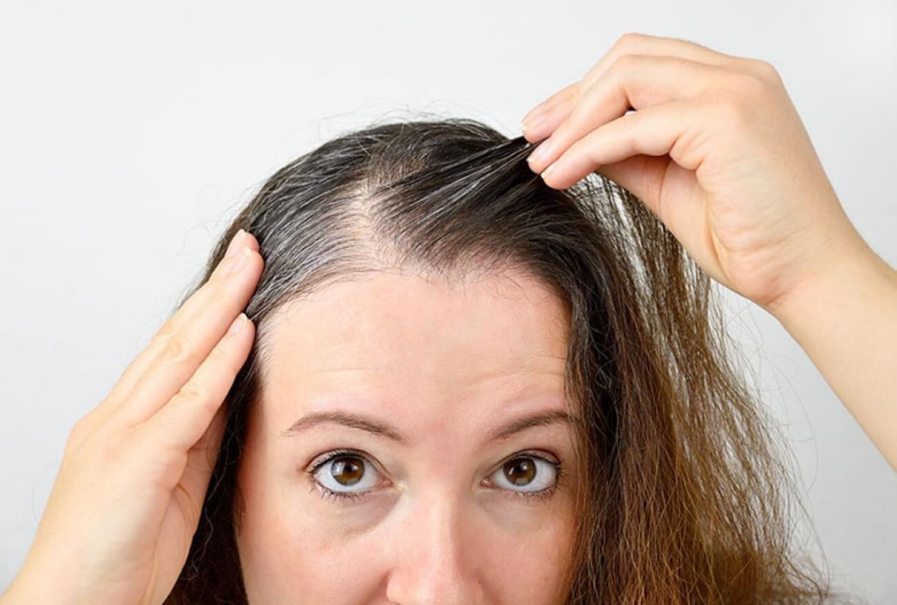 PRP Therapy for Hair Loss