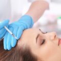 PRP Therapy for Hair Loss