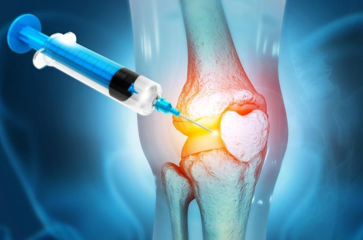 PRP injections