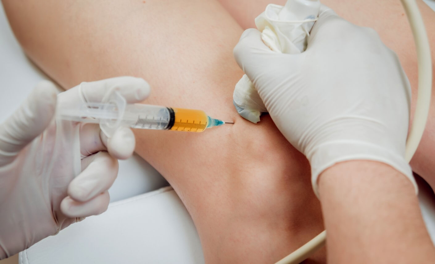 PRP injections