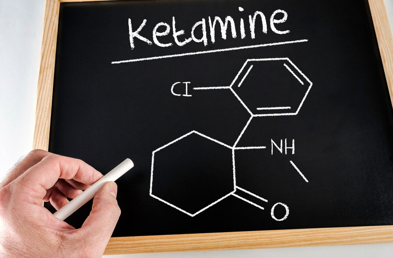 Ketamine for Depression