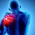 Managing Pain
