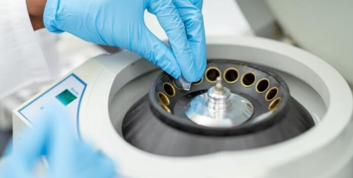 PRP Treatments