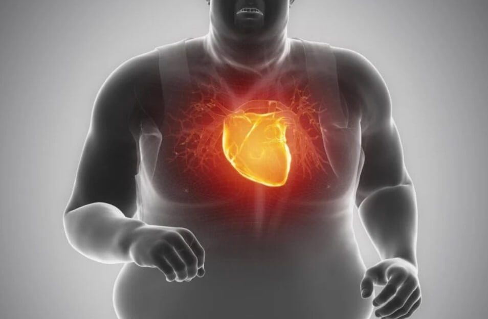 Benefits of Weight Loss