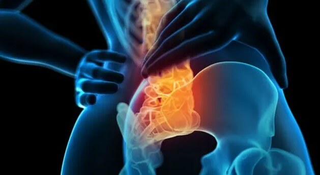 Back Pain Management
