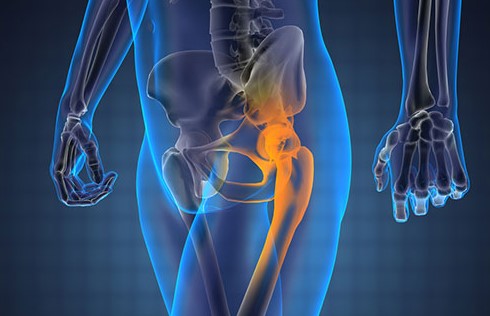 Pain Management for Hip Pain