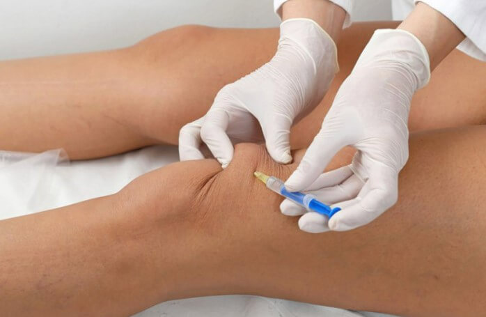 Knee Arthritis Treatment