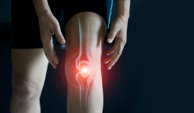 Knee Arthritis Treatment
