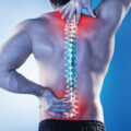 Neck and Back Pain