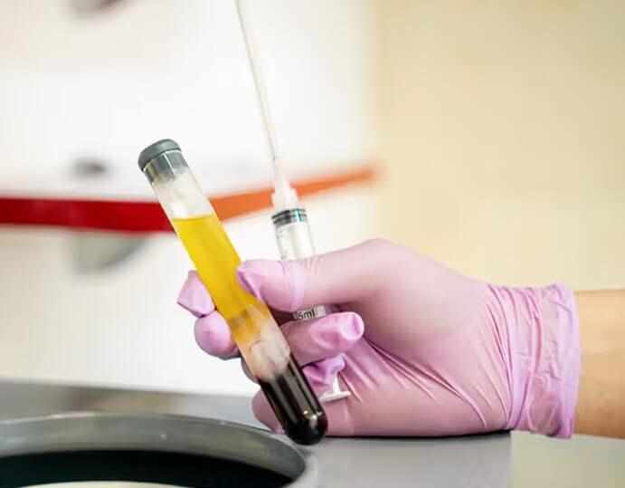 Knee Pain PRP Therapy