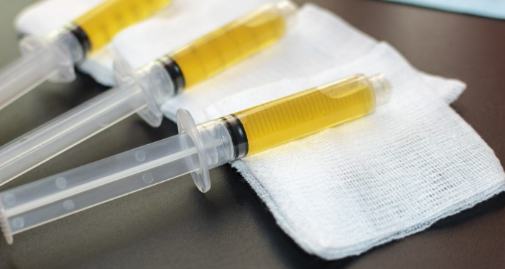 Platelet-Rich Plasma Therapy