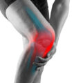How Long Does a Knee Injury Take to Heal