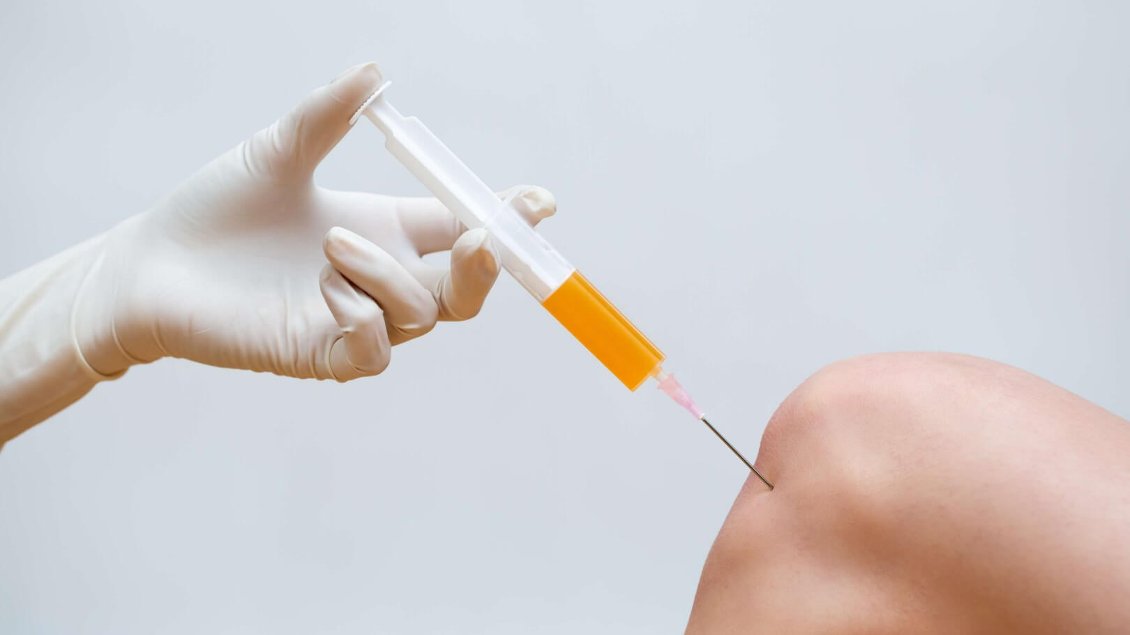 PRP Treatment St. Petersburg