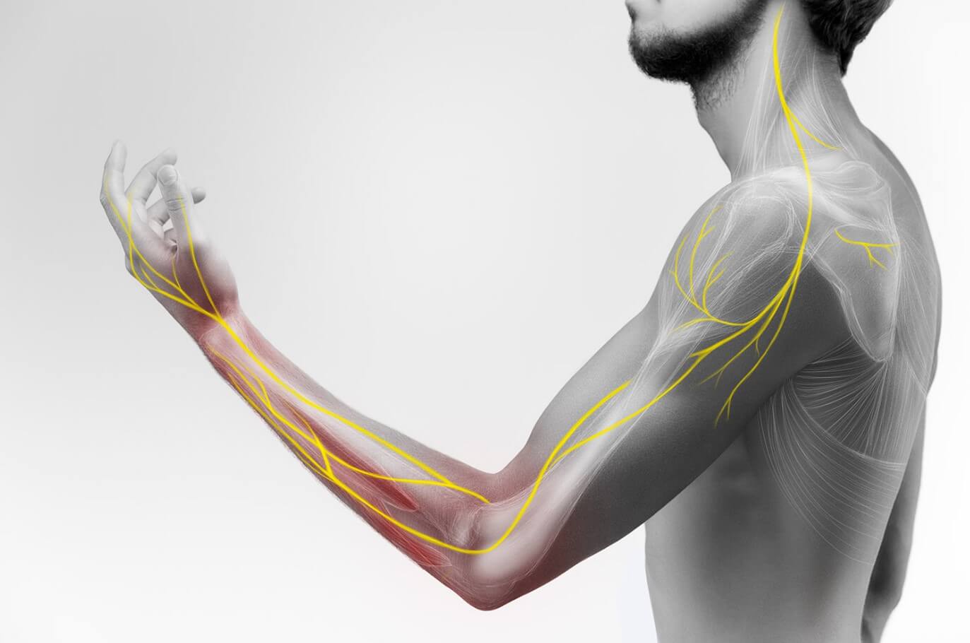 Peripheral Nerve Stimulation Spring Hill FL