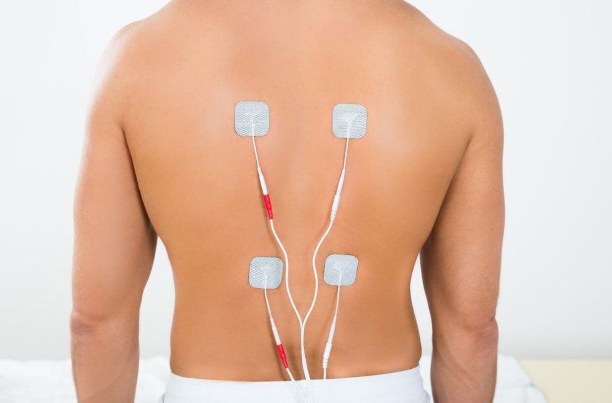 Spinal Cord Stimulation St Petersburg FL