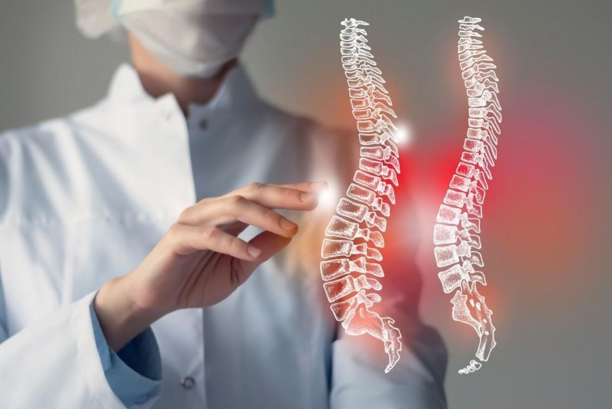 Spinal Cord Stimulation New Port Richey FL