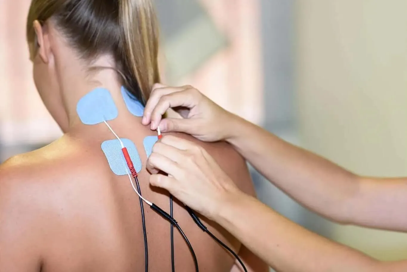 Peripheral Nerve Stimulation Tampa FL